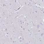 CT45A Antibody in Immunohistochemistry (Paraffin) (IHC (P))