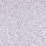 CT45A Antibody in Immunohistochemistry (Paraffin) (IHC (P))