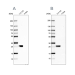 CT45A Antibody in Western Blot (WB)