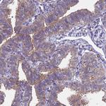 DCAF12L2 Antibody in Immunohistochemistry (Paraffin) (IHC (P))