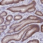 DCAF12L2 Antibody in Immunohistochemistry (Paraffin) (IHC (P))