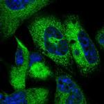 JSRP1 Polyclonal Antibody