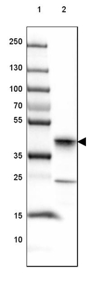 JSRP1 Antibody in Western Blot (WB)