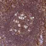 PPP1R18 Polyclonal Antibody