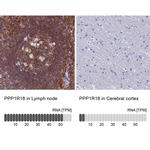 PPP1R18 Antibody in Immunohistochemistry (IHC)