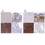 PPP1R18 Antibody in Immunohistochemistry (IHC)