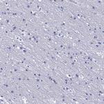PPP1R18 Antibody in Immunohistochemistry (IHC)