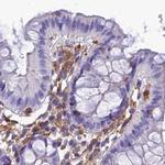 PPP1R18 Antibody in Immunohistochemistry (IHC)