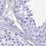 PPP1R18 Antibody in Immunohistochemistry (IHC)