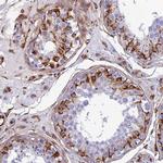 FBXL20 Polyclonal Antibody