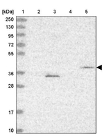 FBXL20 Antibody in Western Blot (WB)