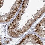 CT45A Polyclonal Antibody