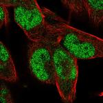 ZNF85 Polyclonal Antibody