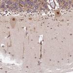 ZNF85 Antibody in Immunohistochemistry (Paraffin) (IHC (P))