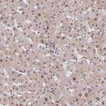 ZNF85 Antibody in Immunohistochemistry (Paraffin) (IHC (P))