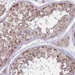 ZNF85 Antibody in Immunohistochemistry (Paraffin) (IHC (P))