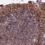 ZNF85 Antibody in Immunohistochemistry (Paraffin) (IHC (P))