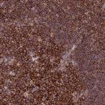 FAM76A Polyclonal Antibody