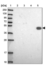 DMRTA1 Antibody in Western Blot (WB)