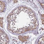 GSPT2 Antibody in Immunohistochemistry (Paraffin) (IHC (P))