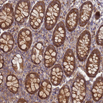 GSPT2 Antibody in Immunohistochemistry (Paraffin) (IHC (P))