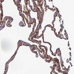 SNX11 Antibody in Immunohistochemistry (IHC)