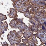 SNX11 Antibody in Immunohistochemistry (IHC)