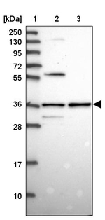 SNX11 Antibody in Western Blot (WB)
