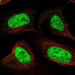 RSRC1 Polyclonal Antibody