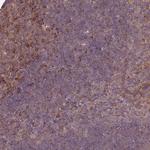 MFSD8 Polyclonal Antibody