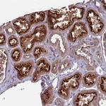 MFSD8 Antibody in Immunohistochemistry (IHC)