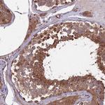 MFSD8 Antibody in Immunohistochemistry (IHC)