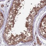MFSD8 Antibody in Immunohistochemistry (IHC)