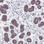 FAM25A Antibody in Immunohistochemistry (IHC)