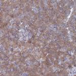TMEM128 Polyclonal Antibody