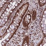 GMEB1 Antibody in Immunohistochemistry (Paraffin) (IHC (P))