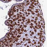 MXRA7 Antibody in Immunohistochemistry (Paraffin) (IHC (P))
