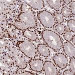 SH3RF3 Antibody in Immunohistochemistry (IHC)