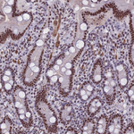 U2AF1 Antibody in Immunohistochemistry (Paraffin) (IHC (P))