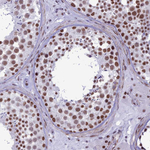 U2AF1 Antibody in Immunohistochemistry (Paraffin) (IHC (P))