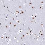 U2AF1 Antibody in Immunohistochemistry (Paraffin) (IHC (P))
