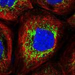 GluD1 Polyclonal Antibody