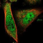 MYEOV2 Polyclonal Antibody