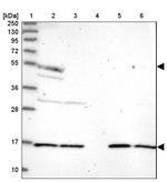 DNPEP Antibody in Western Blot (WB)