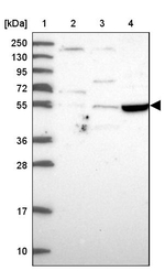 TSPYL4 Antibody in Western Blot (WB)