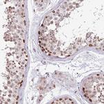 BARD1 Antibody in Immunohistochemistry (IHC)