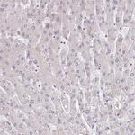 BARD1 Antibody in Immunohistochemistry (IHC)