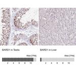 BARD1 Antibody