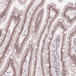 ZNF488 Polyclonal Antibody