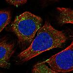 Rabenosyn 5 Polyclonal Antibody